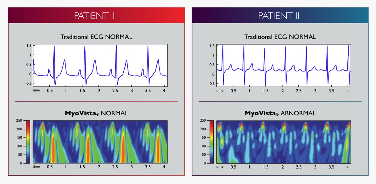 myovista-examples