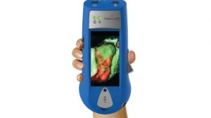 Smith & Nephew launches wound imaging device in Europe