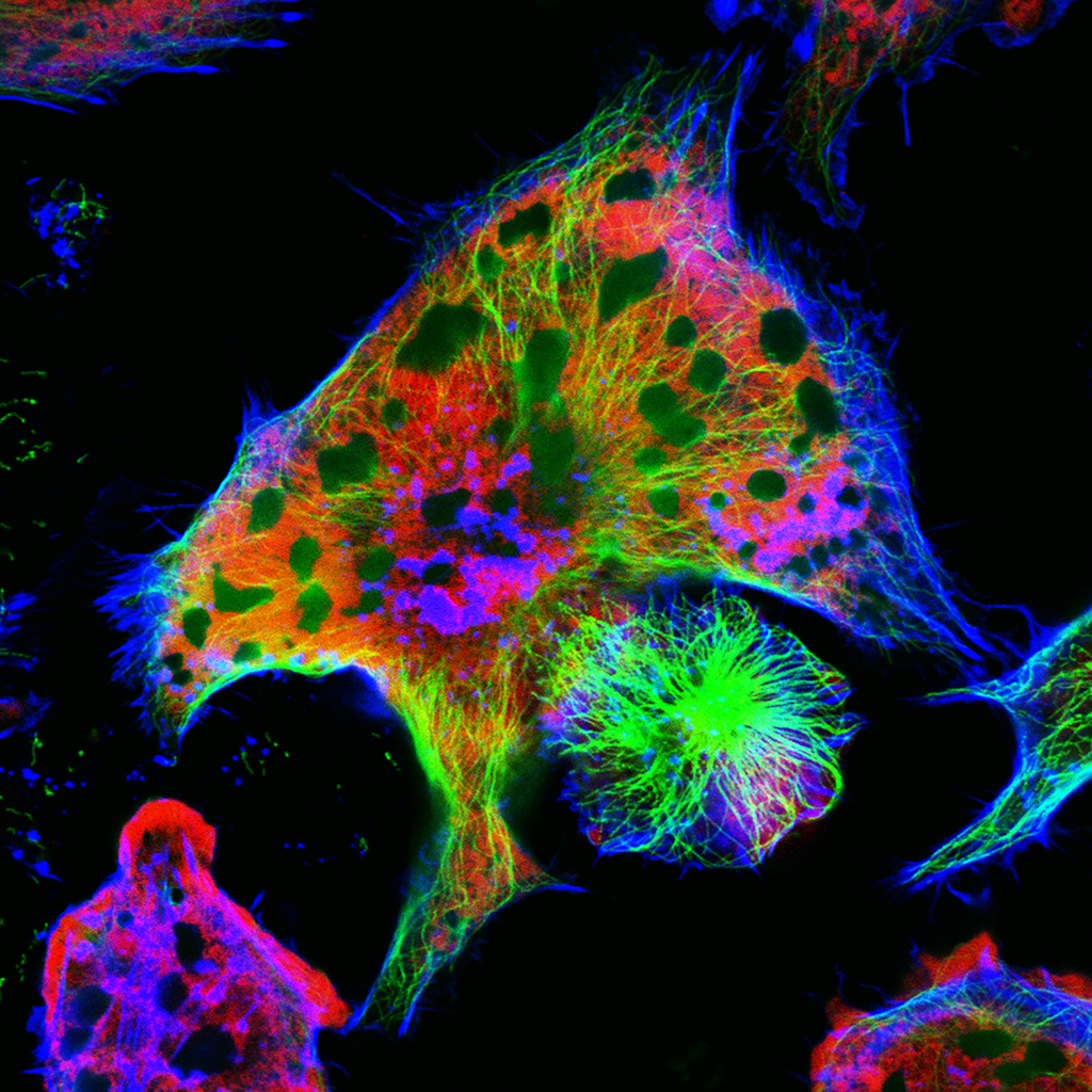 Neuroblastoma cells: nuclei are stained in red purple, microfilaments are in green and in blue