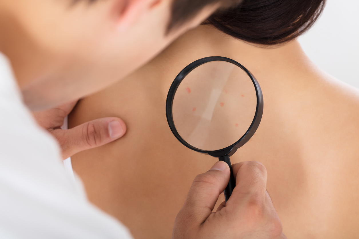 Doctor Checking Skin Of Patient With Magnifying Glass