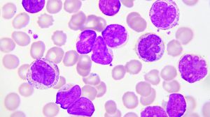 Leukemia cells