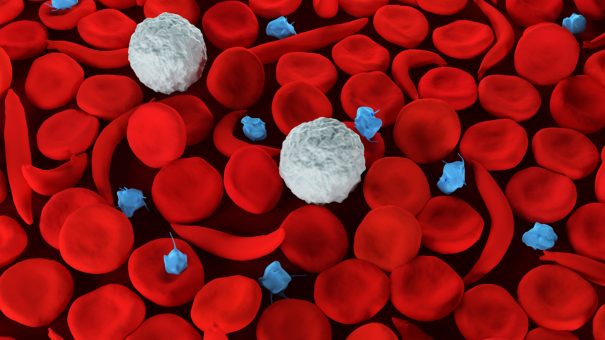 GBT heads to FDA with sickle cell drug voxelotor