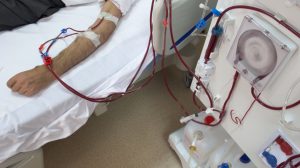 Hemodialysis Machine and Patient