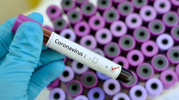 Could Gilead’s Sovaldi be the answer to COVID-19 coronavirus?