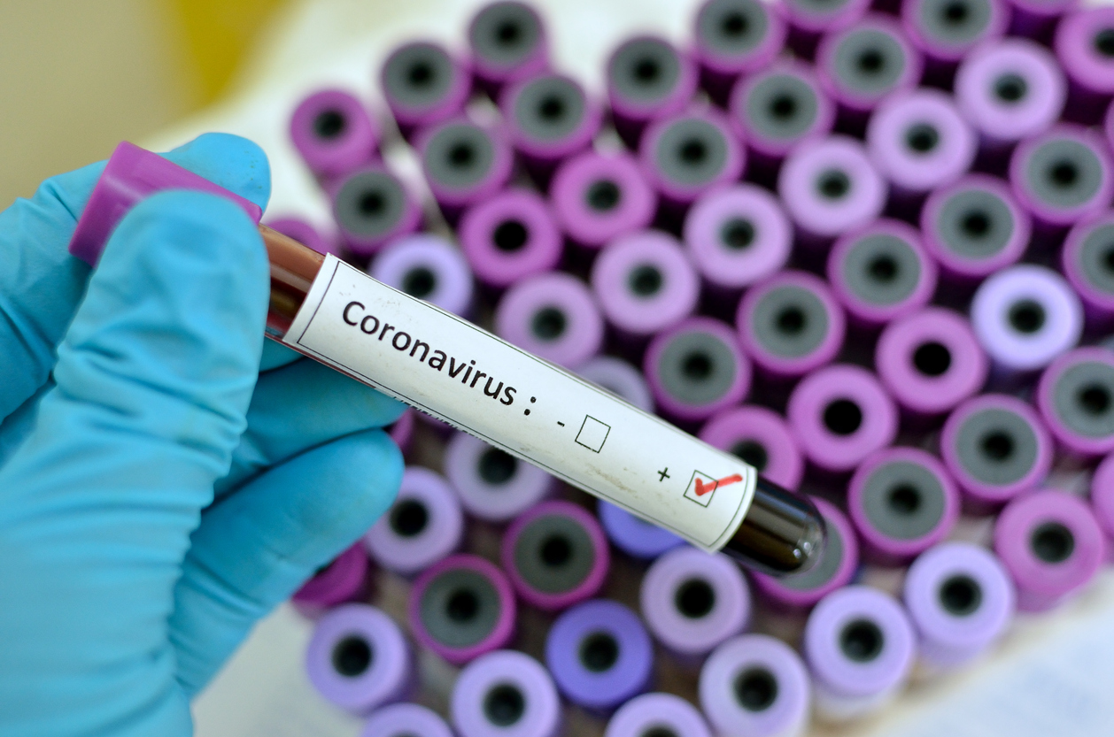 Blood sample with respiratory coronavirus positive