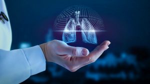 Bayer teams up with Huma to apply AI to lung cancer diagnosis