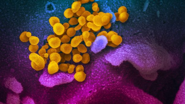 UK doctors call for tighter rules on coronavirus antibody tests