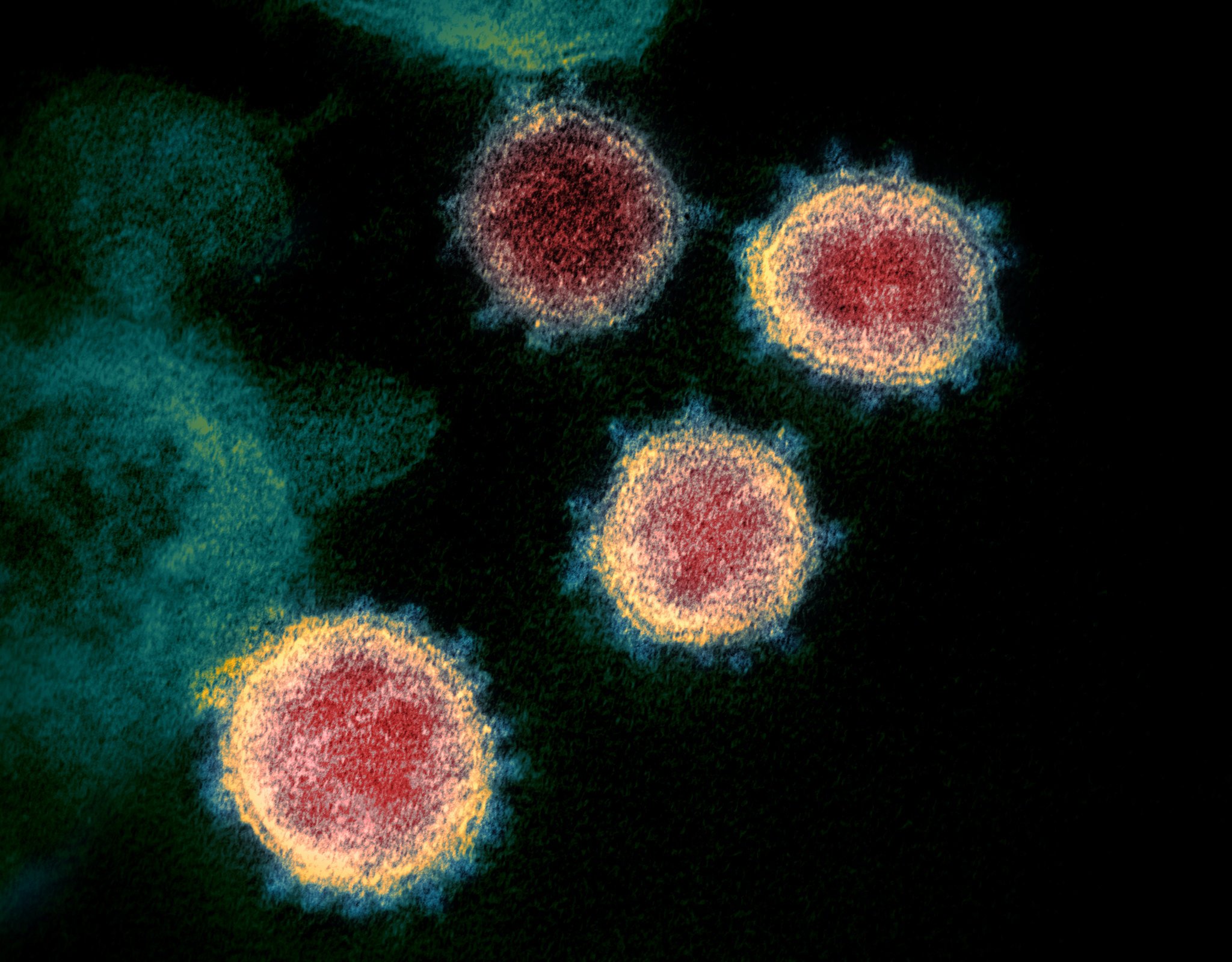 The SARS-CoV-2 coronavirus