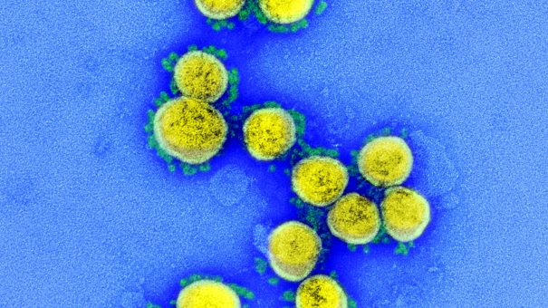 Could AI avert a future coronavirus pandemic?
