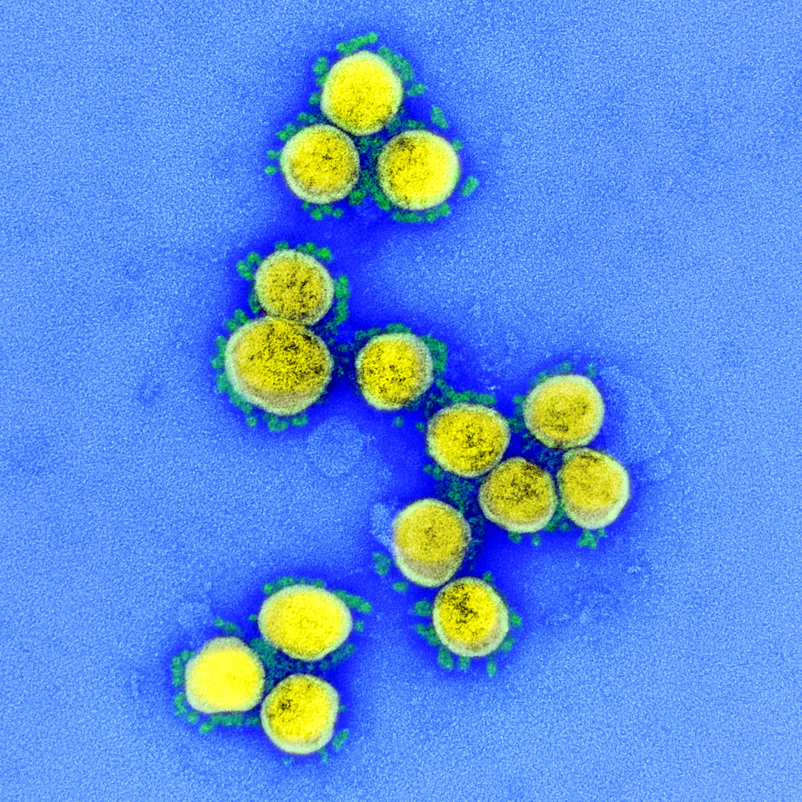 SARS-CoV-2 coronavirus