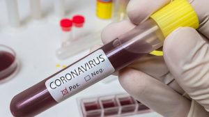 Celltrion to develop coronavirus antibody and fast test