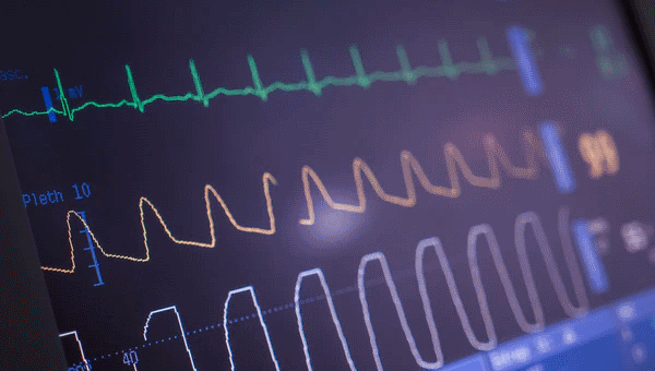 ai-study-will-help-select-afib-patients-for-shock-treatment