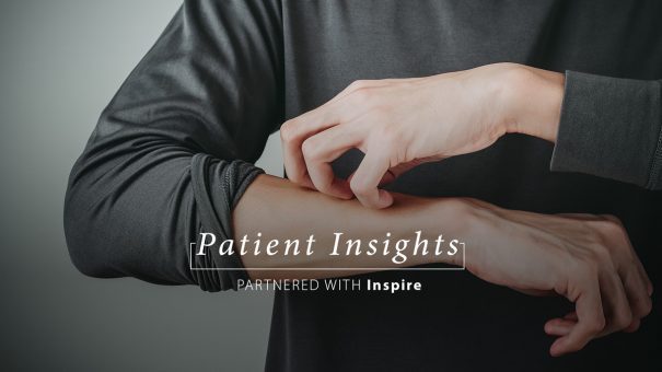 Patient insights- Eczema