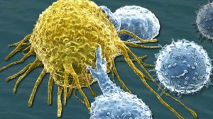 Epsilogen licenses first-in-class IgE ovarian cancer drug