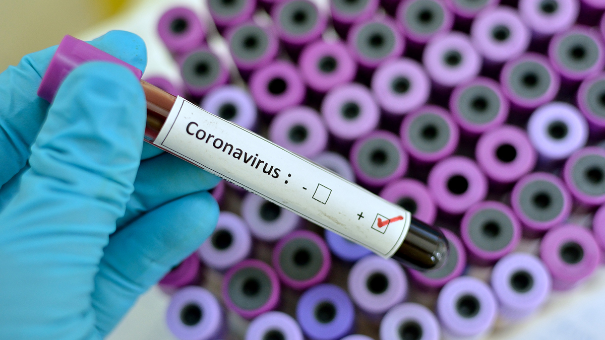 Blood sample with respiratory coronavirus positive