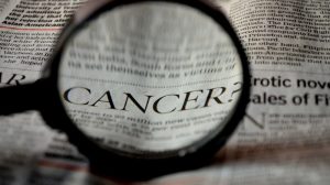 AI health record scanning could identify pancreatic cancer early