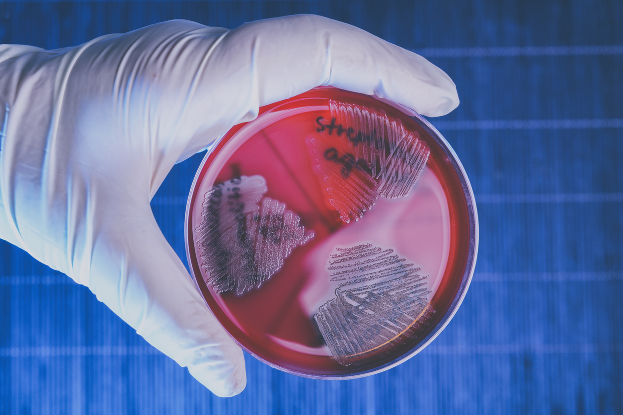 Hand in glove holding Petri plate with bacteria Steptococcus Phaemolifticus G, Streptococcus Agalactiae, Streptococcus Phaemolifticus