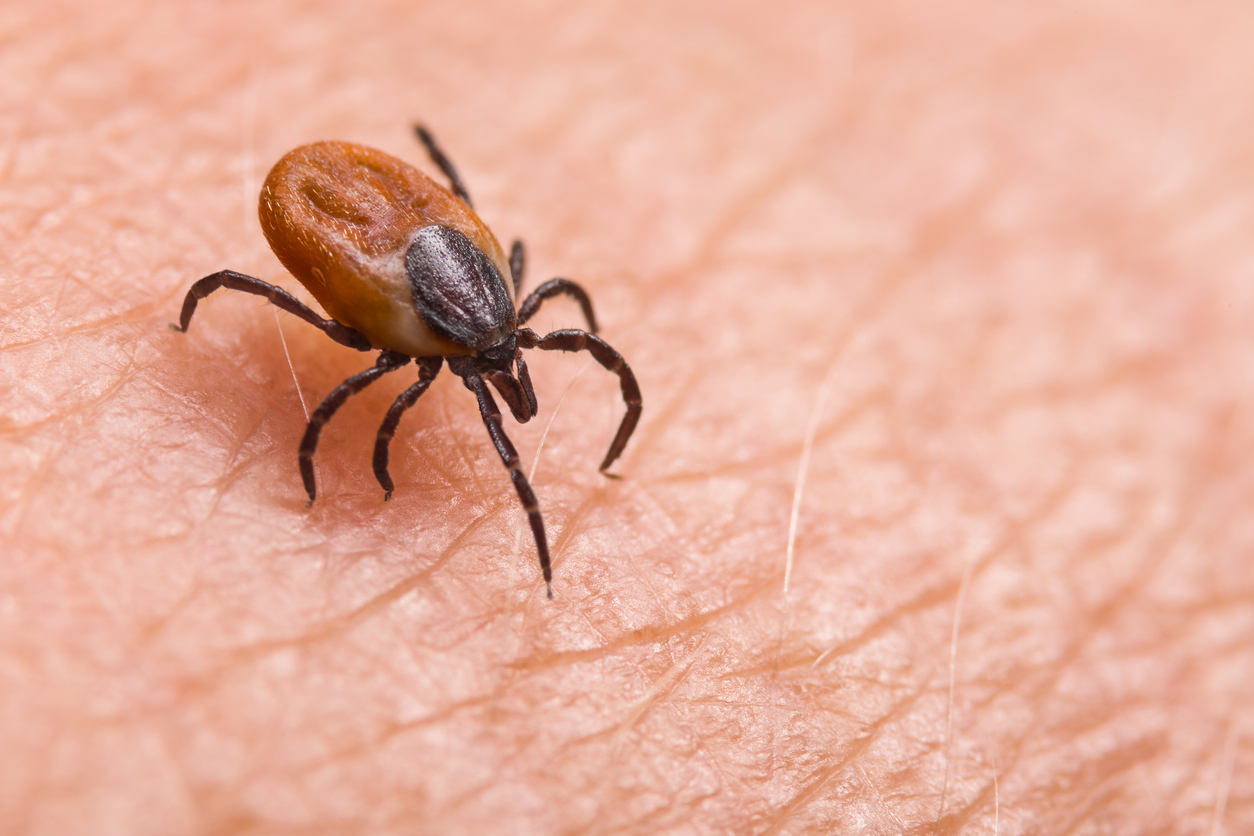 Parasitic biting insect on background of epidermis detail. Disgusting carrier of encephalitis, Lyme disease or babesiosis infections. Tick-borne diseases