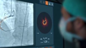 Abbott bags FDA okay for AI-based heart imaging software
