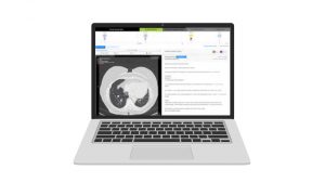 J&J lung cancer initiative will use Optellum’s ‘digital biomarker’ tech
