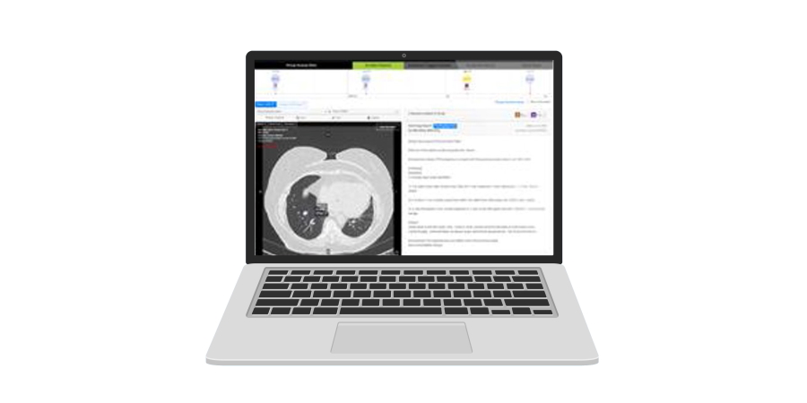 Virtual_Nodule_Clinic_Optellum