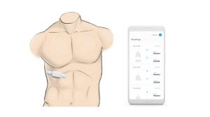 Respira Labs’ wearable device listens for lung diseases